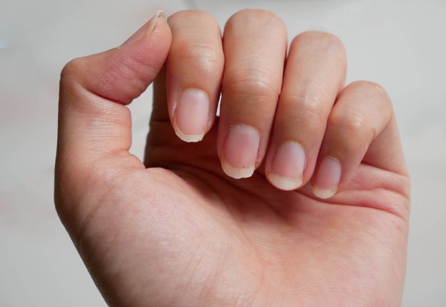 Check out Fingernail Health | Splitting Nails VS. Healthy Nails at https://naildesigns.com/fingernail-health/