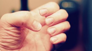brittle damaged nails | remedies for dry cuticles | Featured